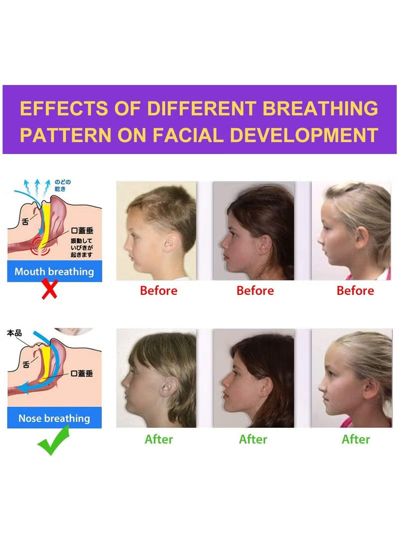 Advanced Anti-Snore Mouth Strips