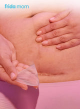 C-Section Silicone Scar Patches