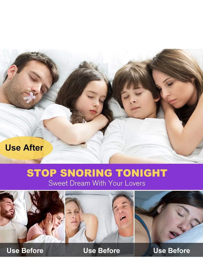 Advanced Anti-Snore Mouth Strips
